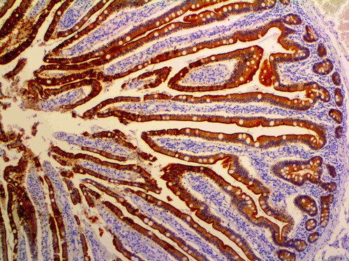 IHC of Villin on an FFPE Colon Tissue